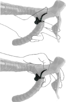 Kind Shock KG DROP 1.0 Aluminium remote lever